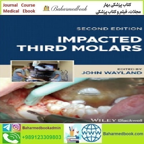 Impacted Third Molars 2024 TRUE PDF price 1€ - کتاب پزشکی بهار