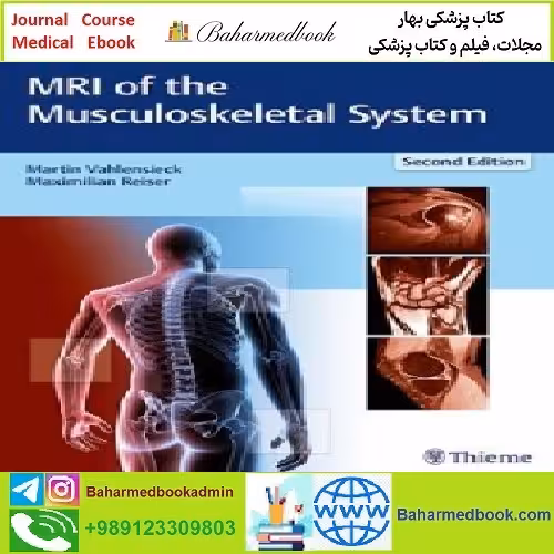 MRI of the Musculoskeletal System TRUE PDF price 1€ - کتاب پزشکی بهار