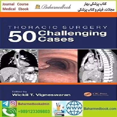 Thoracic Surgery 50 Challenging Cases 2020 TRUE PDF price 1€ - کتاب پزشکی بهار