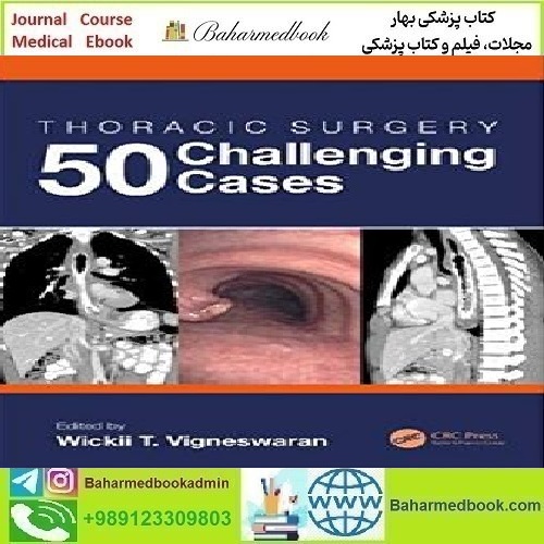 Thoracic Surgery 50 Challenging Cases 2020 TRUE PDF price 1€ - کتاب پزشکی بهار
