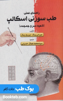 راهنمای عملی طب سوزنی اسکالپ در ناحیه سر و جمجمه