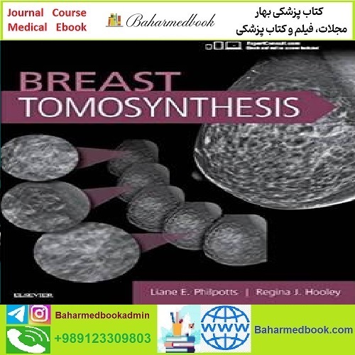 Breast Tomosynthesis TRUE PDF VIDEOS price 2€ - کتاب پزشکی بهار