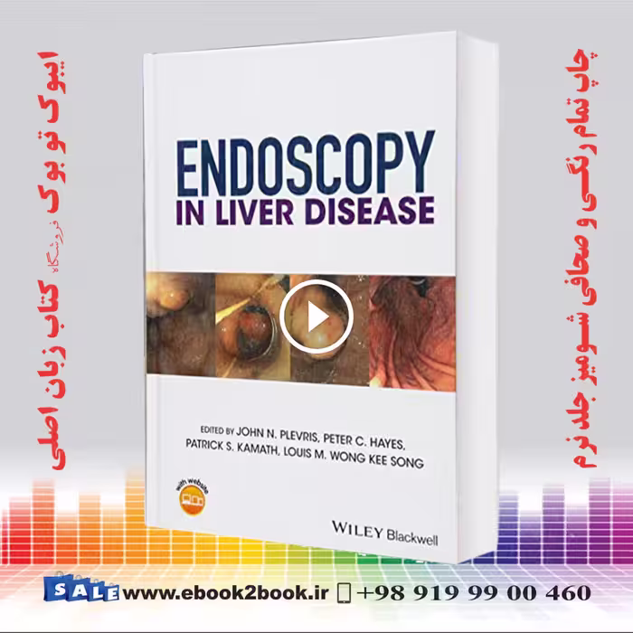 Endoscopy in Liver Disease