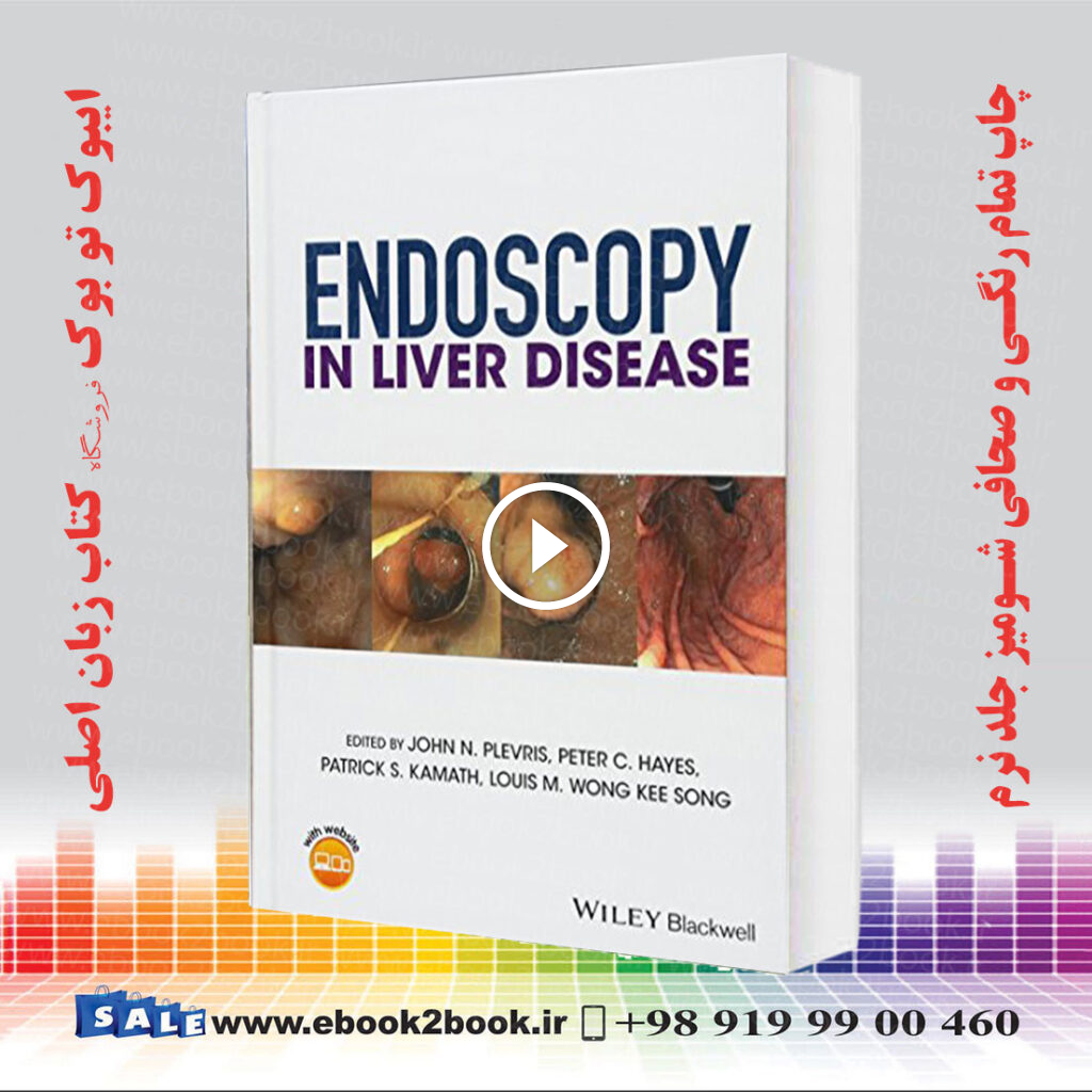 Endoscopy in Liver Disease