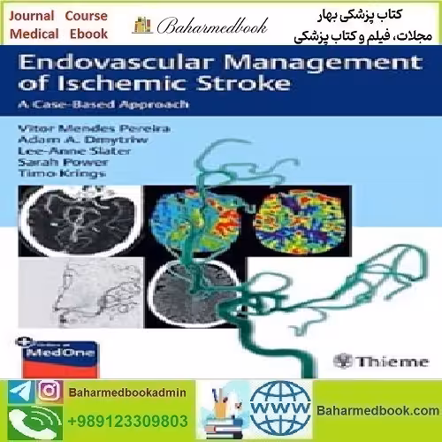 Endovascular Management of Ischemic Stroke 2021 TR