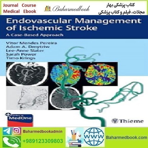 Endovascular Management of Ischemic Stroke 2021 TR