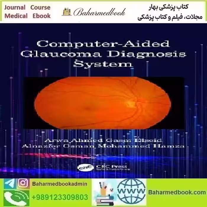Computer Aided Glaucoma Diagnosis System 2020
