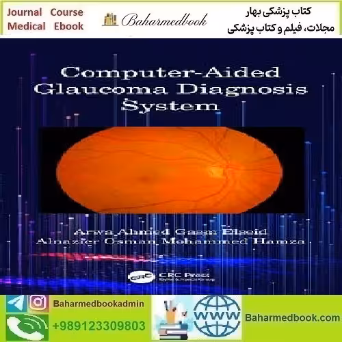Computer Aided Glaucoma Diagnosis System 2020