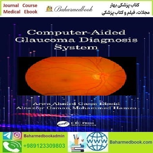 Computer Aided Glaucoma Diagnosis System 2020
