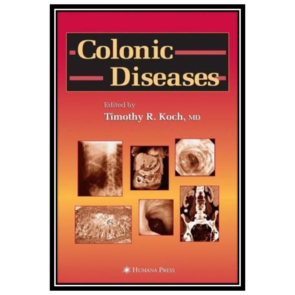 کتاب Colonic Diseases اثر Timothy R Koch انتشارات مؤلفین طلایی