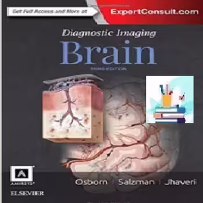 Brain TRUE PDF price 1€