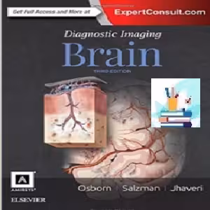 Brain TRUE PDF price 1€