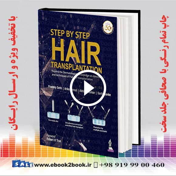 Step by Step Hair Transplantation