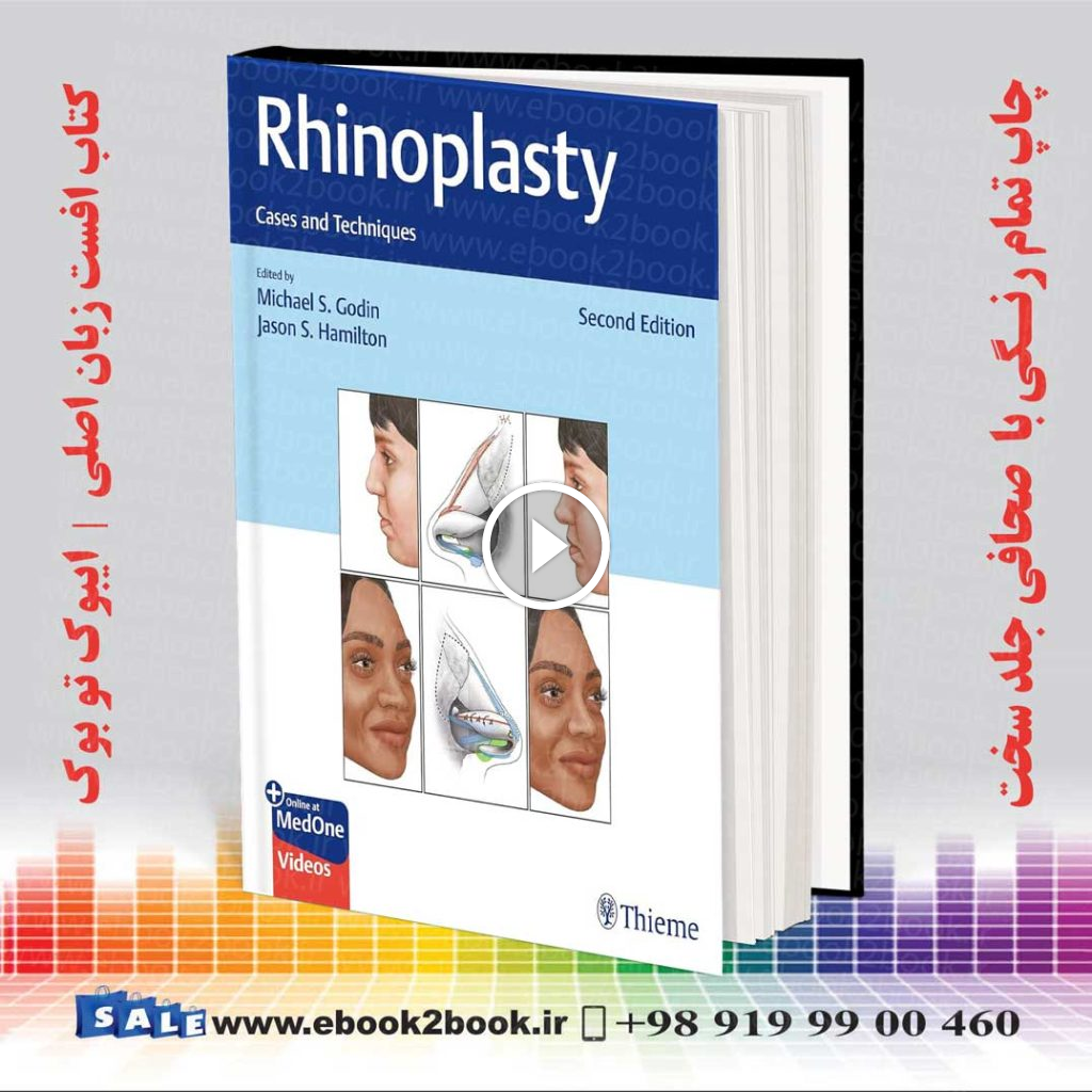 Rhinoplasty: Cases and Techniques 2nd Edition