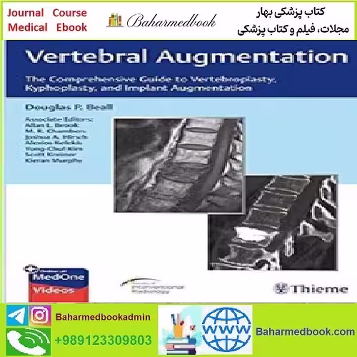 Vertebral Augmentation TRUE PDF price 1€ - کتاب پزشکی بهار