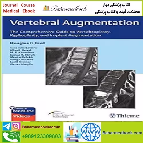 Vertebral Augmentation TRUE PDF price 1€ - کتاب پزشکی بهار