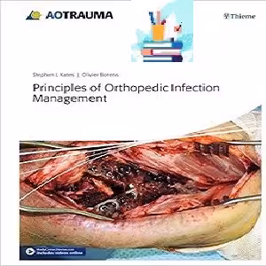 Principles of Orthopedic Infection Management 1ed PDF Videos at 2€ - کتاب پزشکی بهار