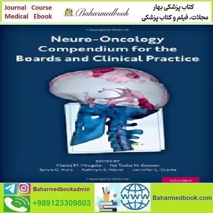 Neuro Oncology Compendium for the Boards and Clinical Pr