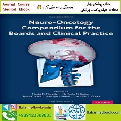 Neuro Oncology Compendium for the Boards and Clinical Pr