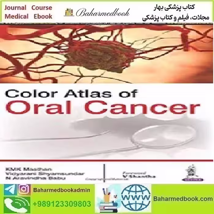 Color Atlas of Oral Cancer 2016 TRUE PDF price 1€ - کتاب پزشکی بهار