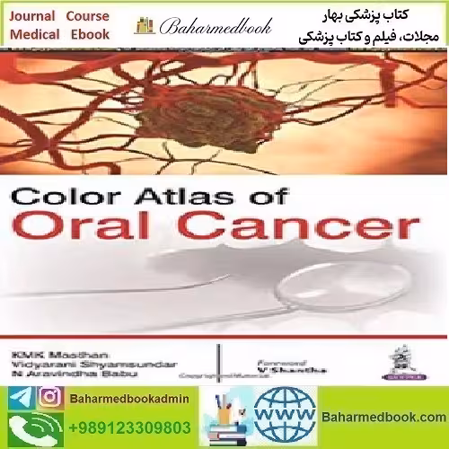 Color Atlas of Oral Cancer 2016 TRUE PDF price 1€ - کتاب پزشکی بهار