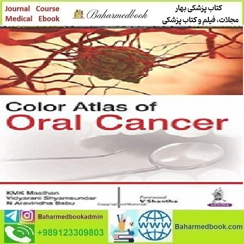 Color Atlas of Oral Cancer 2016 TRUE PDF price 1€ - کتاب پزشکی بهار