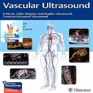 Vascular Ultrasound B-Mode Color Doppler and Duplex Ultrasound Contrast-Enhanced Ultrasound TRUE PDF VIDEOS price 3€ - کتاب پزشکی بهار