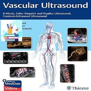 Vascular Ultrasound B-Mode Color Doppler and Duplex Ultrasound Contrast-Enhanced Ultrasound TRUE PDF VIDEOS price 3€ - کتاب پزشکی بهار