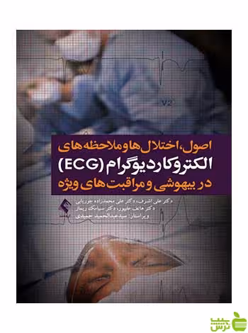 الکتروکاردیوگرام ECG در بیهوشی و مراقبت های ویژه ارجمند - سیب ترش - SibTorsh