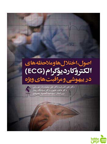 الکتروکاردیوگرام ECG در بیهوشی و مراقبت های ویژه ارجمند - سیب ترش - SibTorsh
