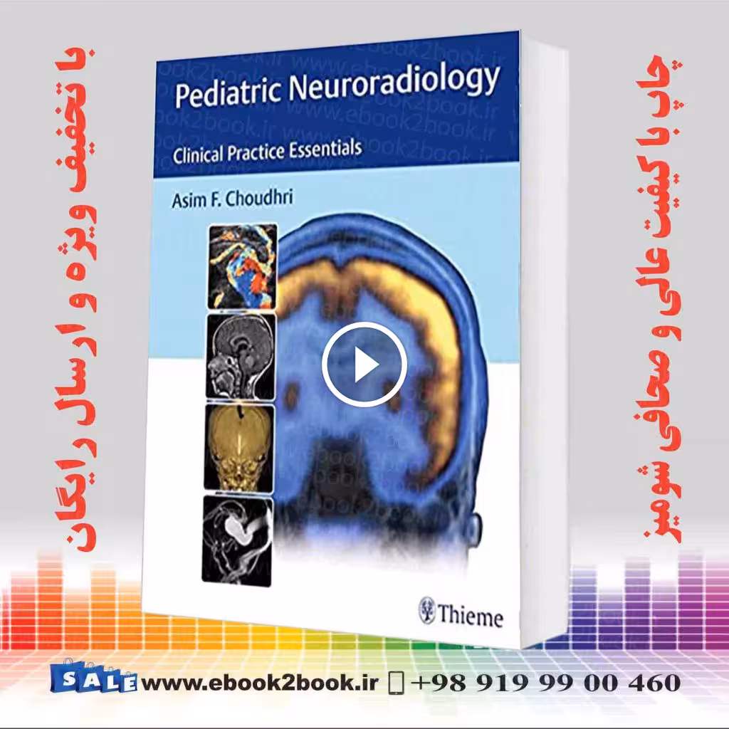 نورولوژی اطفال | Pediatric Neuroradiology