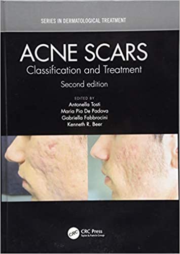 Acne Scars: Classification and Treatment 2019 - کتاب پزشکی بهار