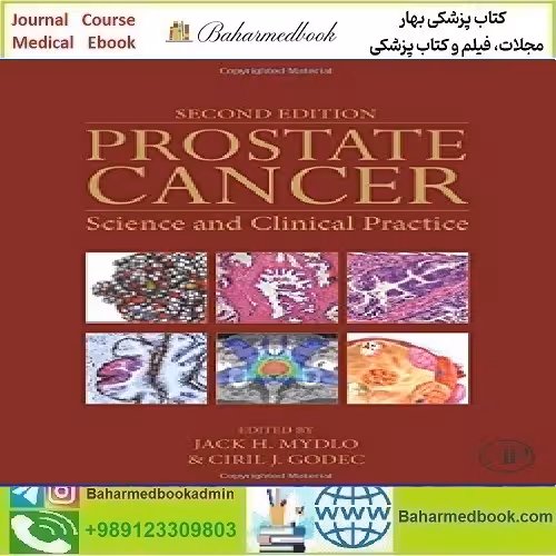 Prostate Cancer  Science and Clinical PracticeTRUE PDF price 1€ - کتاب پزشکی بهار