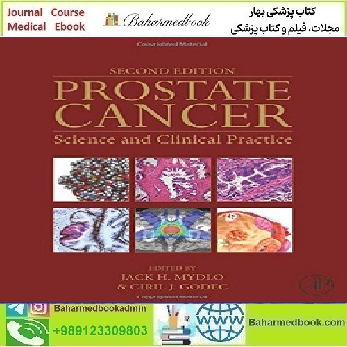Prostate Cancer Science and Clinical PracticeTRUE PDF price 1€ - کتاب پزشکی بهار