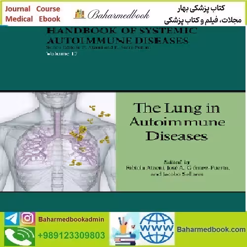 Handbook of Systemic Autoimmune Diseases Volume 17 202