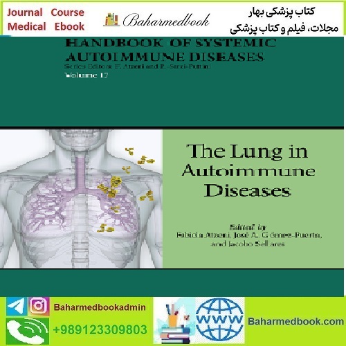 Handbook of Systemic Autoimmune Diseases Volume 17 202