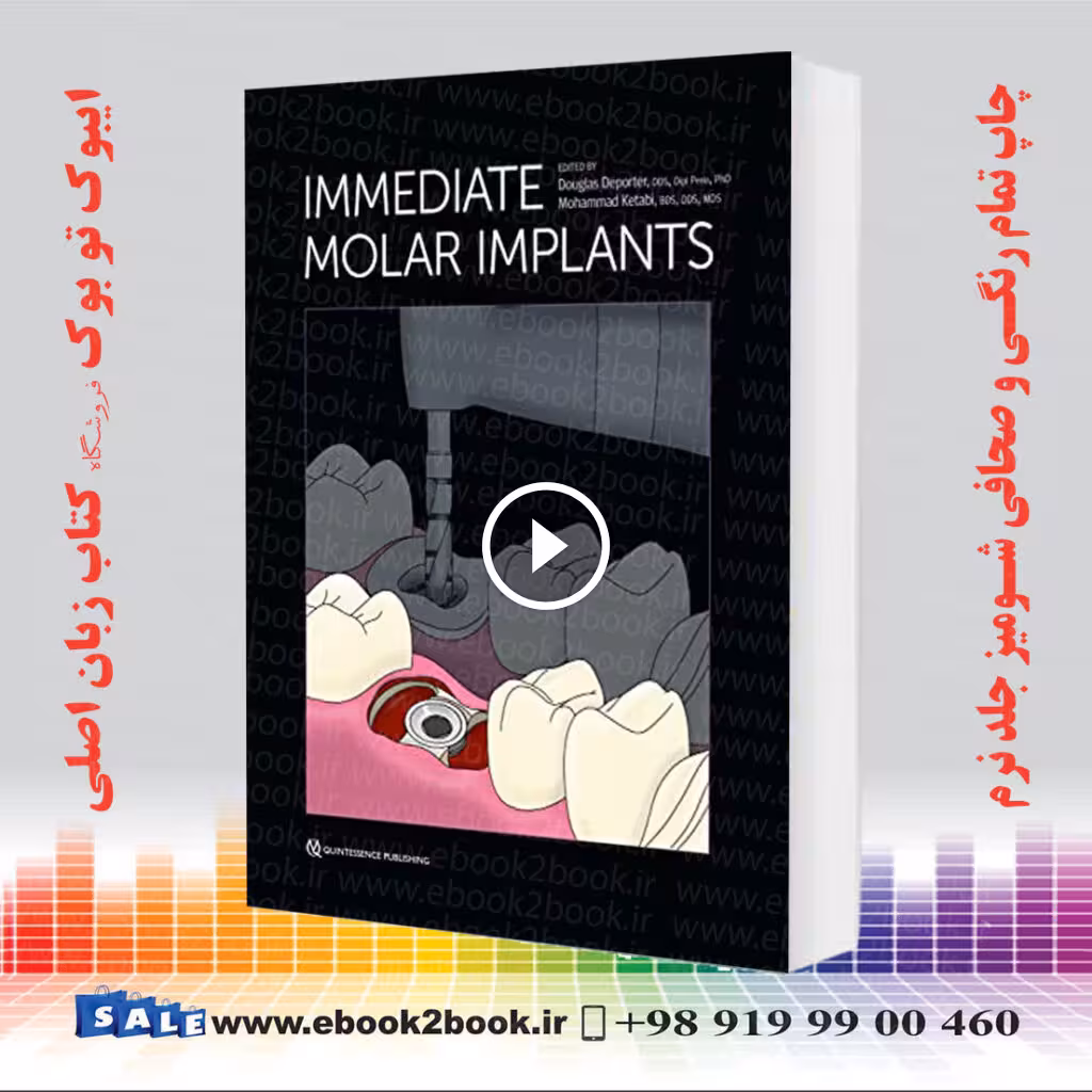 Immediate Molar Implants