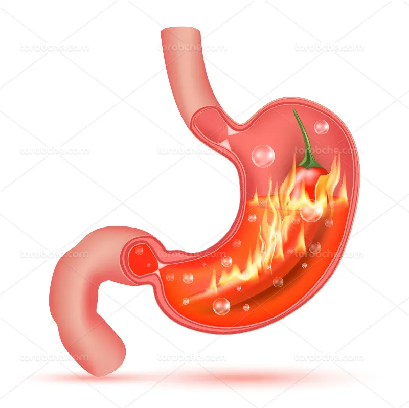 وکتور سوزش معده | گرافیک با طعم تربچه