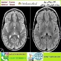 MRIOnline Mastery Series Neurofibromatosis Type 1 NF1 2021 v