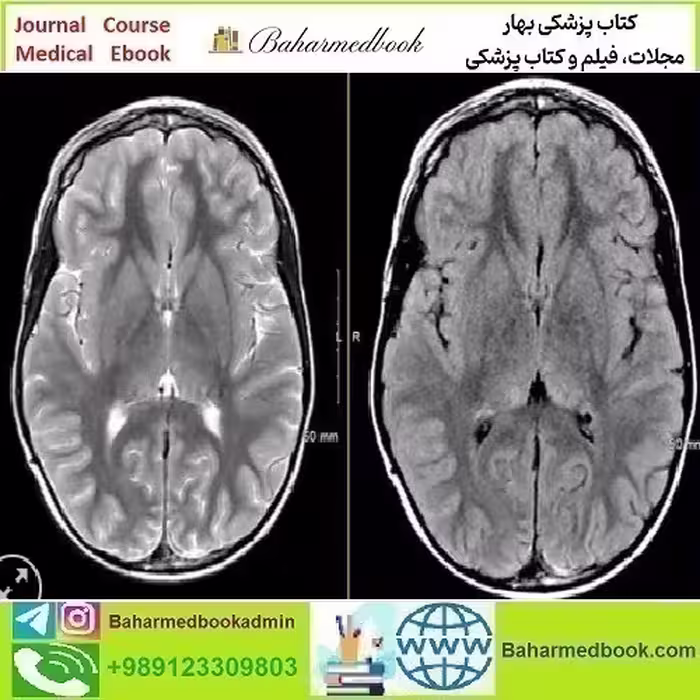 MRIOnline Mastery Series Neurofibromatosis Type 1 NF1 2021 v