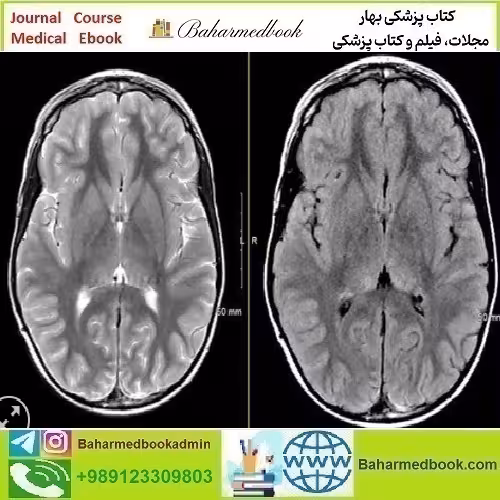 MRIOnline Mastery Series Neurofibromatosis Type 1 NF1 2021 v