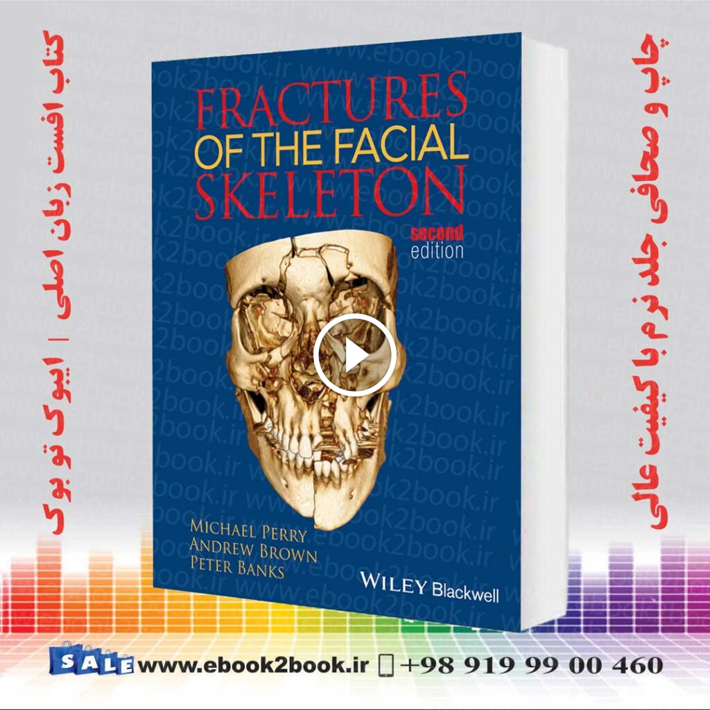 Fractures of the Facial Skeleton 2nd Edition