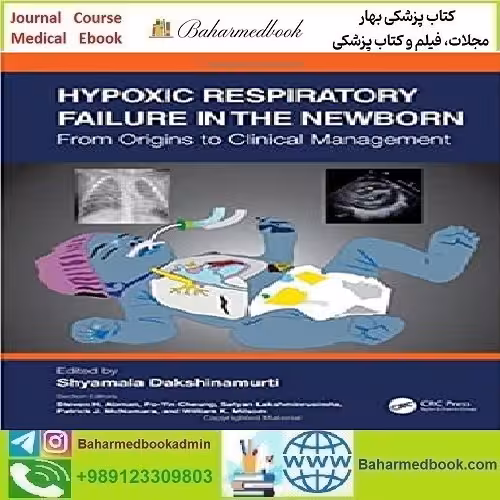 Hypoxic Respiratory Failure in the Newborn 2021