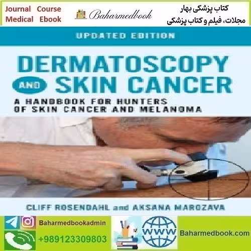 Dermatoscopy and Skin Cancer 2023 TRUE PDF price 1€ - کتاب پزشکی بهار