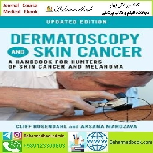 Dermatoscopy and Skin Cancer 2023 TRUE PDF price 1€ - کتاب پزشکی بهار