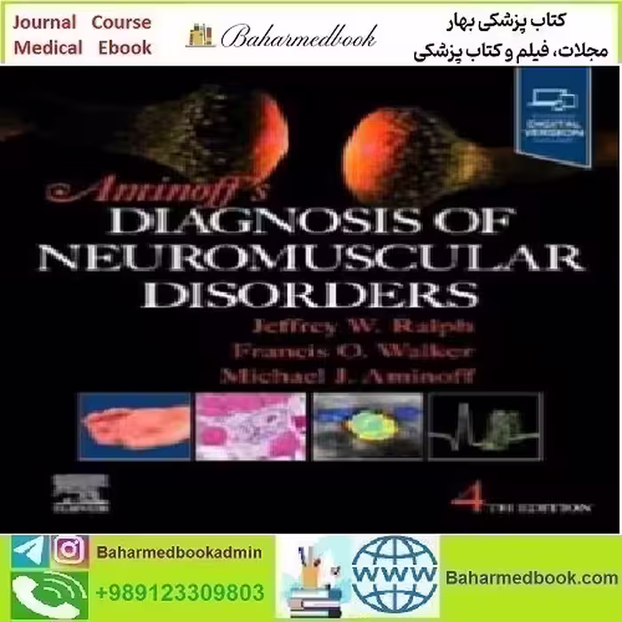 Aminoff's Diagnosis of Neuromuscular Disorders 2025