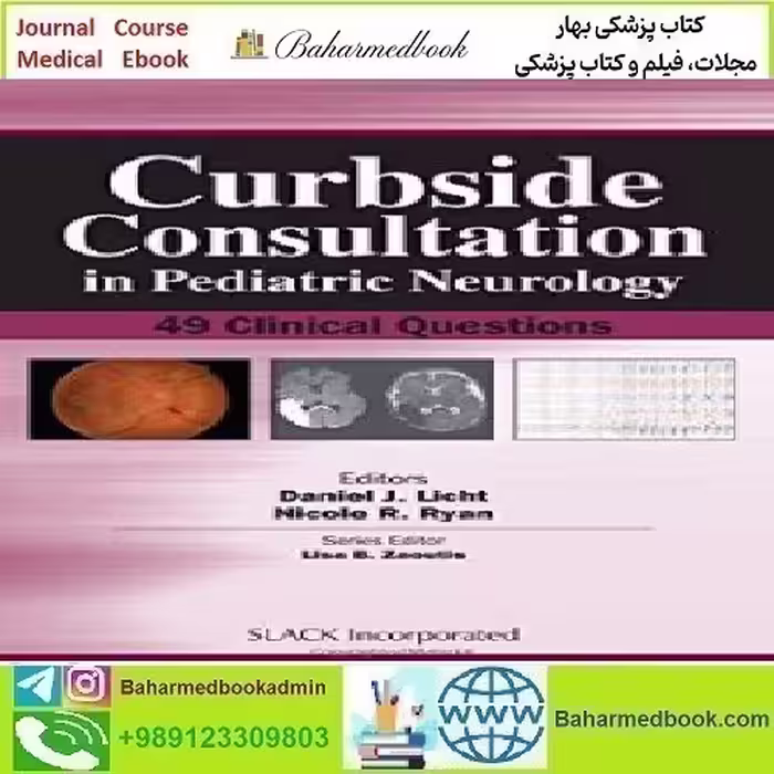 Curbside Consultation in Pediatric Neurology 49 Clinical Questi