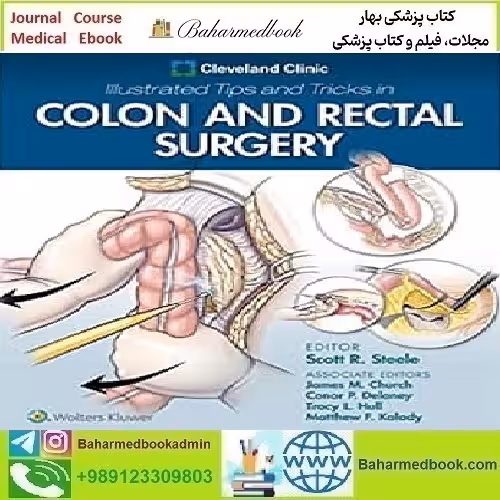 Cleveland Clinic Illustrated Tips and Tricks in Colon and Rectal