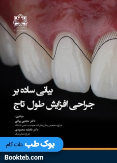 بیانی ساده بر جراحی افزایش طول تاج