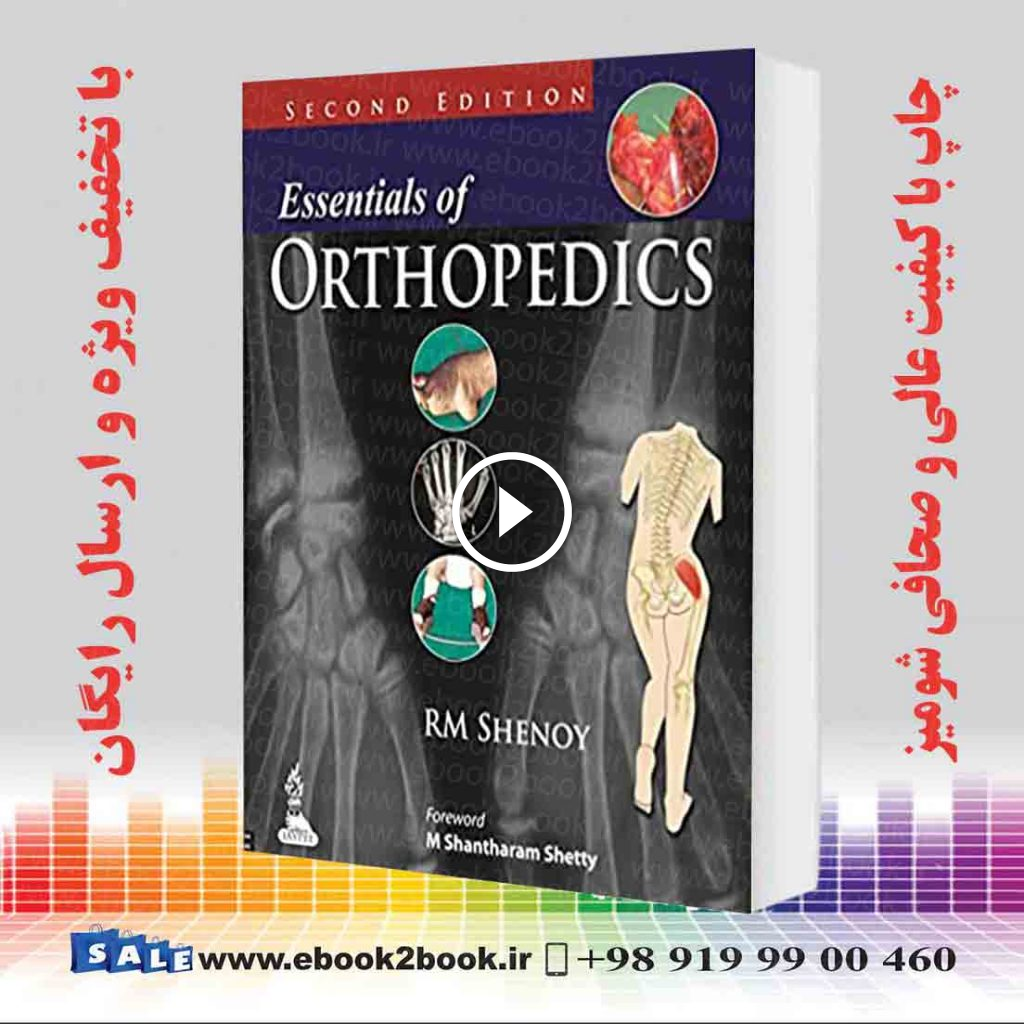 Essentials of Orthopedics 2nd Edition